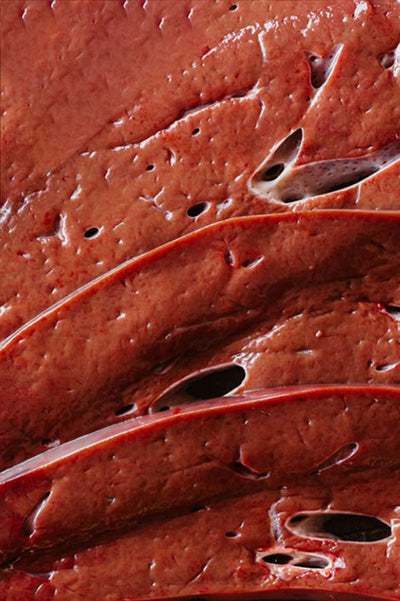 Vitamin B12